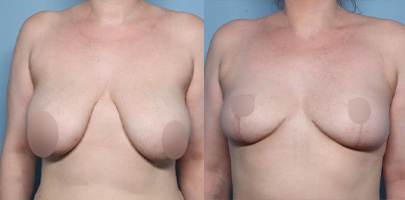 Zochowski-Homepage-rsult05