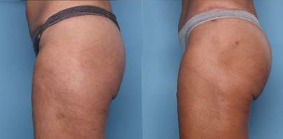 Zochowski-Homepage-rsult3