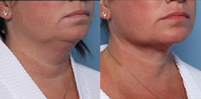 Zochowski-Homepage-rsult4