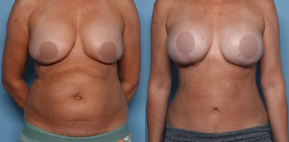 Zochowski-Homepage-rsult6